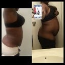 before and after side view 20 hours later