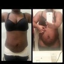 before and after front view 20 hours later