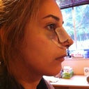 Day 1 Post Op (morning after surgery) - Side view
