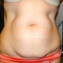 Front view of tum and shelf "Before"