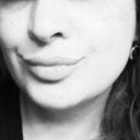 All I can say, is that each day I see results... I feel like I should post more pictures, so here they come. October 18, 2012. Front view. Still a little tight below the chin, this is normal and I expected this. (Lips enchanced with Juvederm).