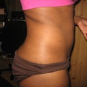 Before- Side view
