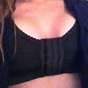 Post Op Day 1