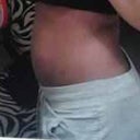 Swollen but no more hanging belly.