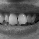 Top Teeth