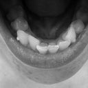 Bottom Teeth