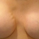 Before- Notice the rippling