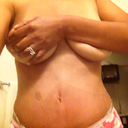post op day 3