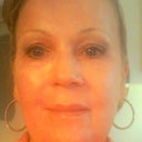 3 1/2 weeks following my peel.  My upper lip is still swollen.