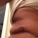 60 days PO...obsessed with the flabby on my right side & the dog ears