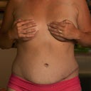 12 weeks post and loving it!