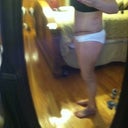 10 Days PO  Dog ear on left side? nice flat belly.  No more c-section lap apron.