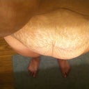 my left side is larger because I have scar tissue from my c-section