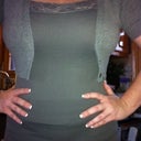 Another pic so you can see the swelling in the lower region....ugh