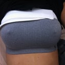 day 8 still with band till day 11 post op