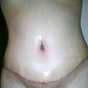 3 weeks Pos Op