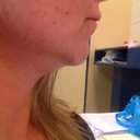 Jowls and sagging