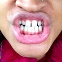 Hahaha there! Not my most attractive look but its just to serve the purpose to show my issue.