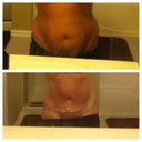 5 days before touch up lipo