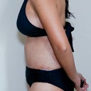 Day 5 post op. Don't know why I have a little pooch right where my ribcage starts.