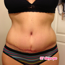 Right after mowing my yard & using the workout binder.  So see...not too swollen.