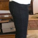 9 Days Post-Op