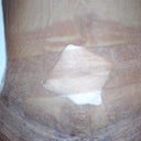 1 day after the surgery front