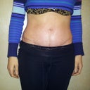 6 WEEKS P.O.