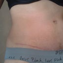 8 WEEKS right side