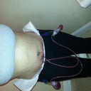 post opt day 2