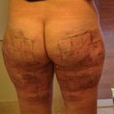 After procedure