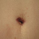 my bellybutton's scabs have fallen off. I like that the scar is small and 'inside.'