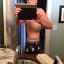 POST OP DAY 25 - Side 1