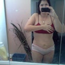 3 days after my liposuction procedure :)