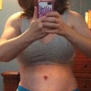 day 12, in the morning. Lots of swelling and can't wait till everything is healed