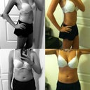 2 Days Pre-Op  -verses-  2 Weeks Post-Op