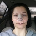 Day 1- taken in the car on my way home from surgery.