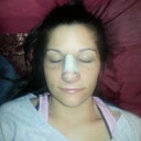 Day 7- (6 days post op) went back to work...(I'm a pediatric nurse)