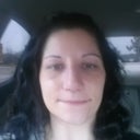 Day 8 (7 days post op)- Splint off and stitches out.