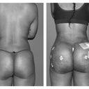 This is 2nd day post bbl... Can't wait to see final results!