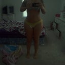 front 2 weeks post op