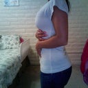 Same shirt I wore with sizers 2.5 weeks post surgery