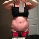 Tummy straight on - PO day 34