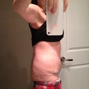 PO day 34 side view. Slight swelling but also some extra Christmas weight :( I know it is swelling though when I lie down flat, my tummy is convex instead of concave like pre surgery.