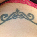 Here is a week after 1 stomach treatment.  I'm trying to find my before pic and will ask Caddell's if they might have one to email me.