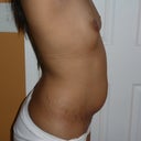 Now you see them, now you dont! ( when I raise my arms up my boobs disappear) lol