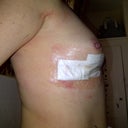 Side view 24 hours