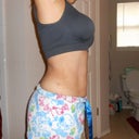 10 weeks post op