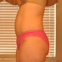 6 months PO side