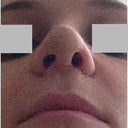 Day 8 - Really uneven nostrils!